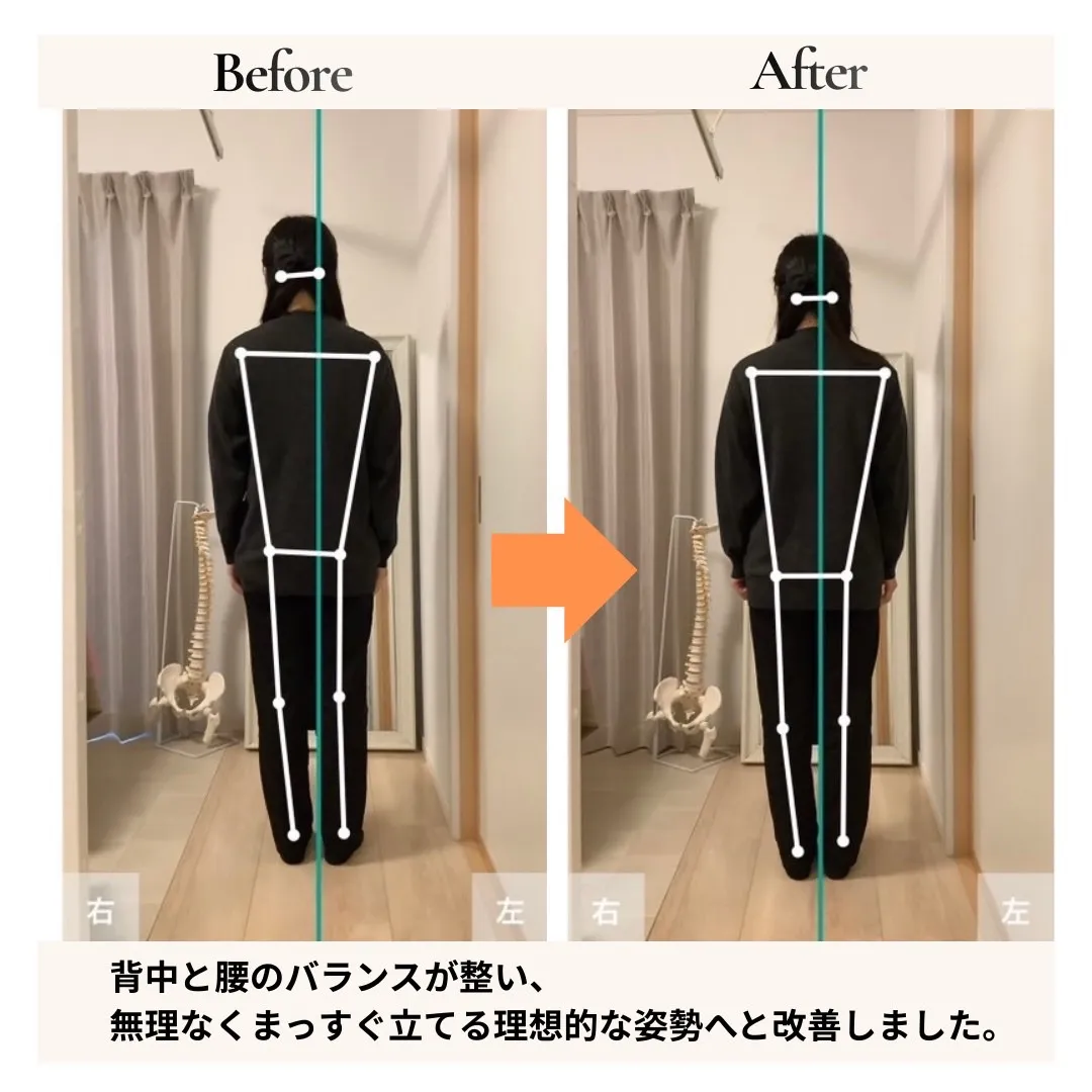 姿勢改善の事例